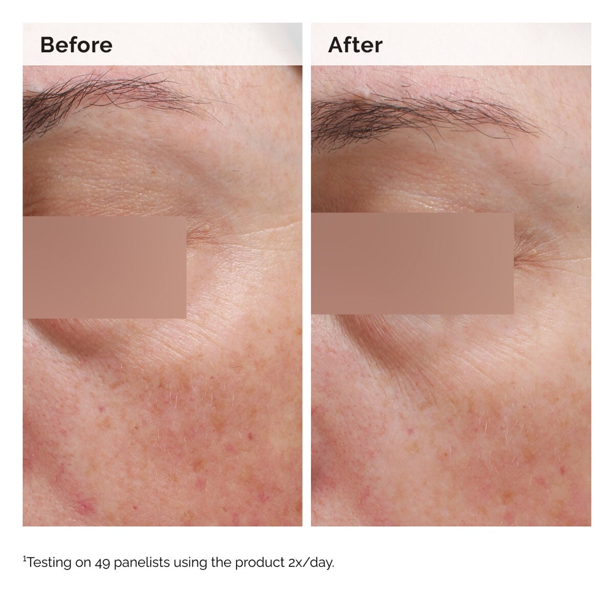 niacinamide-5-face-and-body-emulsion-z0 2024-08-23-ORD-Nia-5pct-Face-Body-B-A-Elasticity-Global-02-1x1.jpg