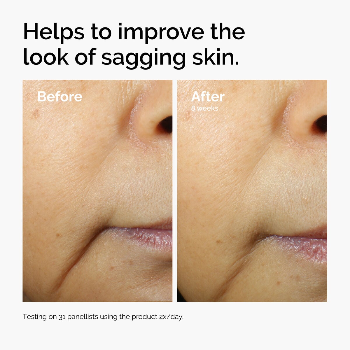caffeine-3-escin-1-face-serum-q4 ord-caffeine-3pct-escin-1pct-face-serum-before-after-sagging.jpg