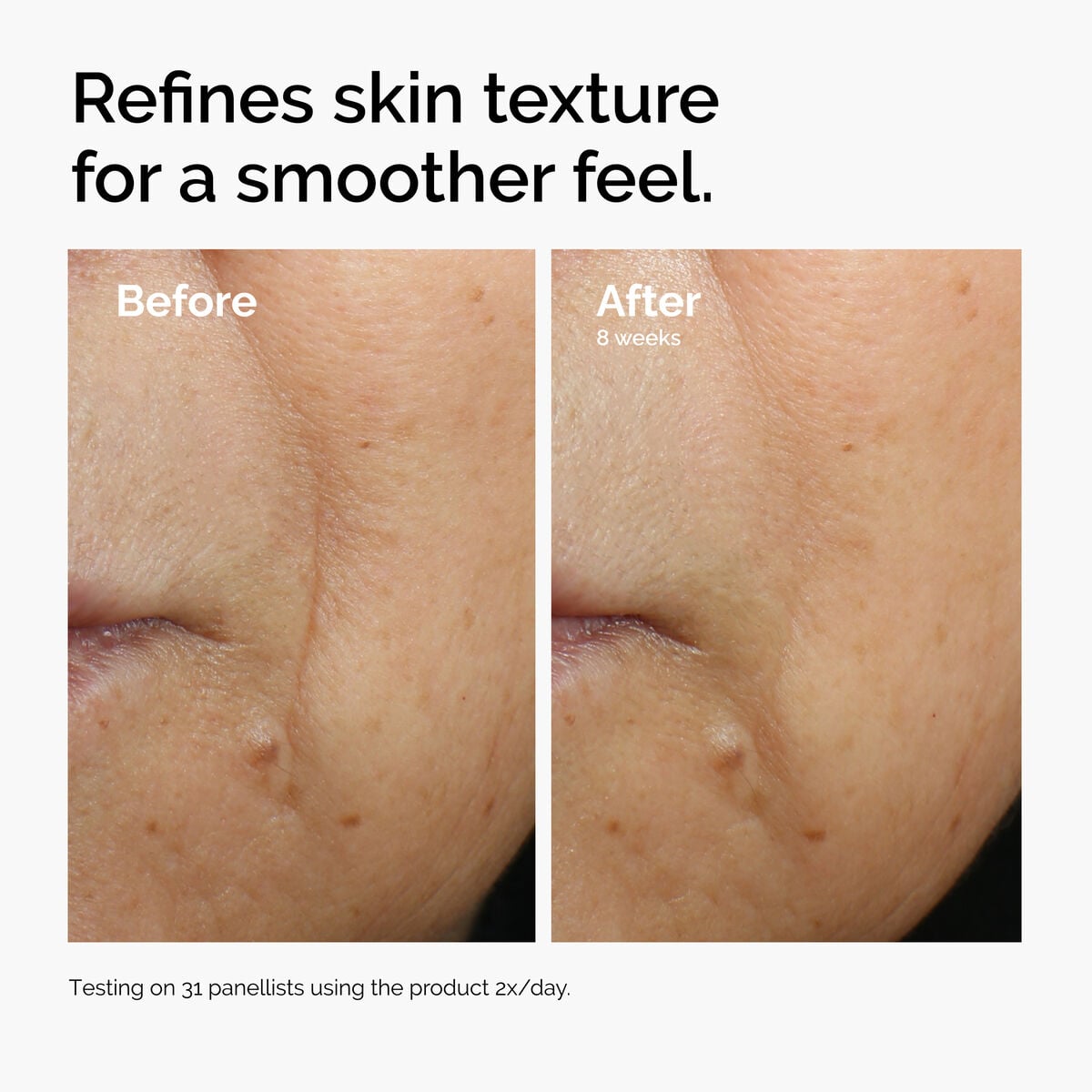 caffeine-3-escin-1-face-serum-q4 ord-caffeine-3pct-escin-1pct-face-serum-before-after-texture.jpg