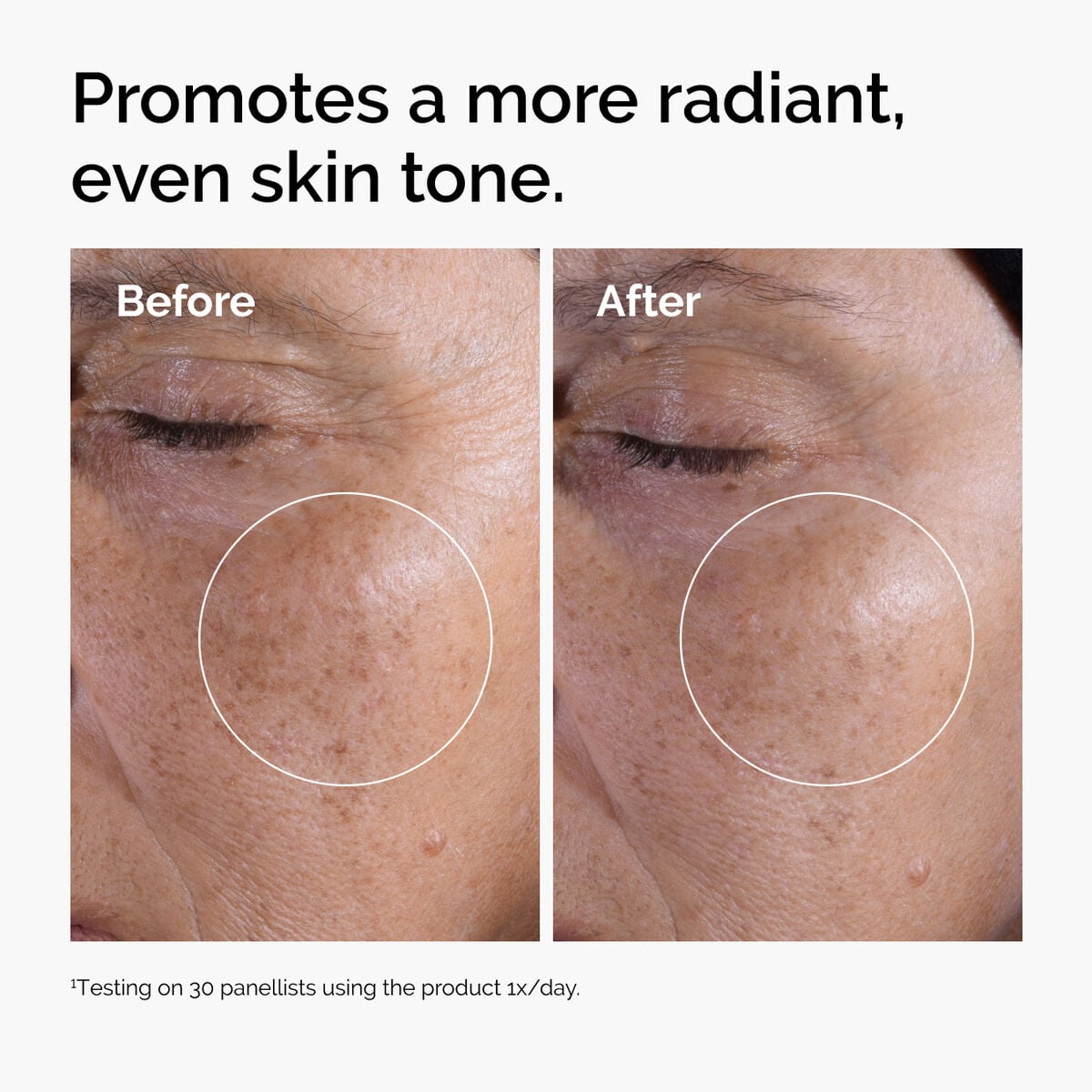 glycolic-acid-7-exfoliating-toner-d1 ord-glycolic-before-after-radiance.jpg