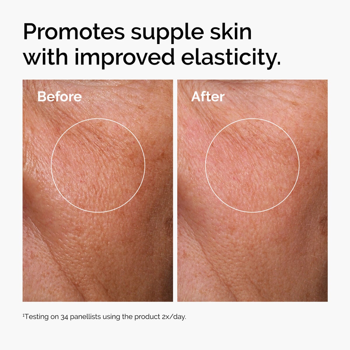 hyaluronic-acid-2-b5-with-ceramides-s5 ord-hyaluronic-acid-2pct-b5-hydrating-serum-before-after-elasticity.jpg