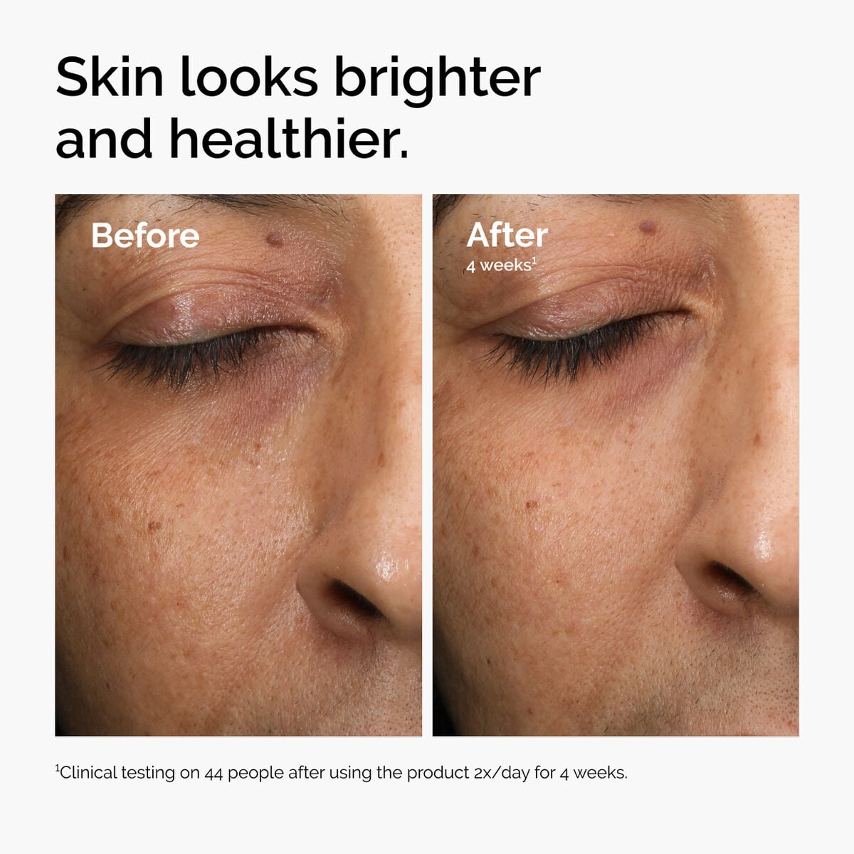 multi-antioxidant-radiance-serum-v5 ord-mars-before-after-healthy.jpg