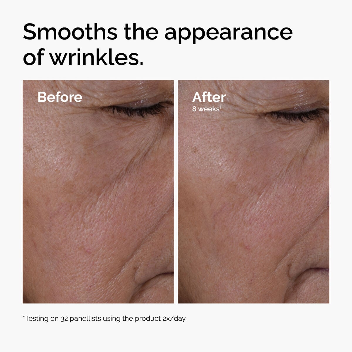 multi-peptide-ha-serum-f5 ord-multi-peptide-ha-serum-wrinkles-before-after.jpg
