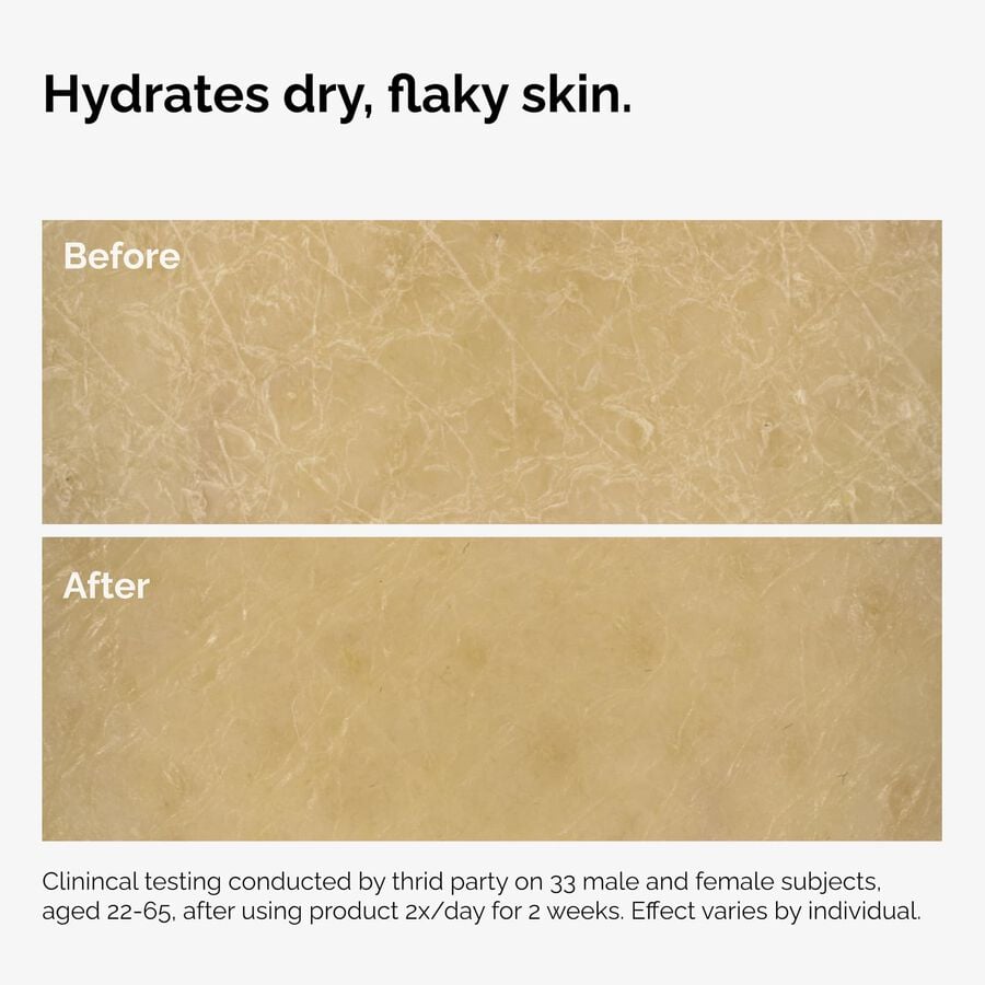 the-body-care-collection-p6 ord-natural-moisturizing-factors-inulin-body-before-after-graphic-02.jpg