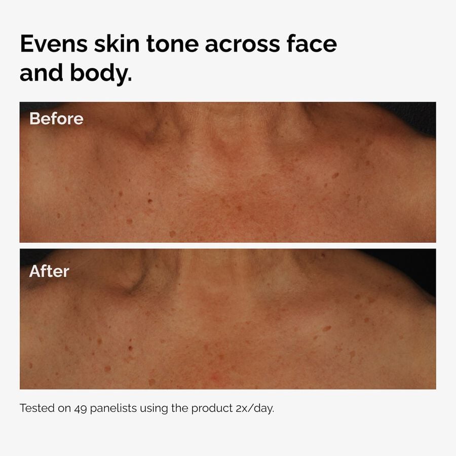 the-body-care-collection-p6 ord-niacinamide-face-body-serum-before-after-even-tone-graphic.jpg