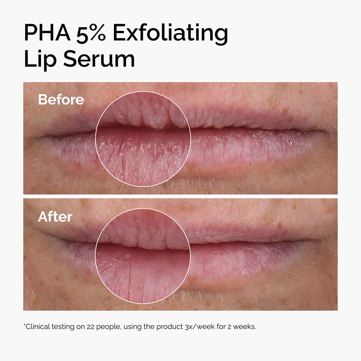 pha-5-exfoliating-lip-serum-h0 ord-pha-5pct-lip-exfoliating-serum-before-after.jpg